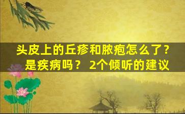 头皮上的丘疹和脓疱怎么了？是疾病吗？ 2个倾听的建议
